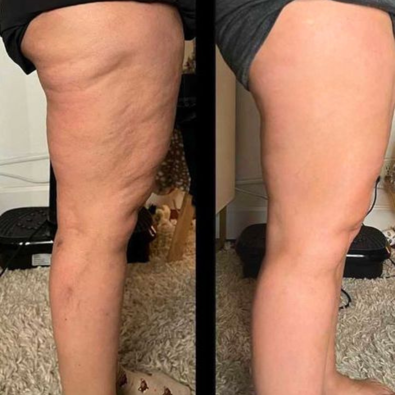 Oce Aura Anti-cellulittkrem