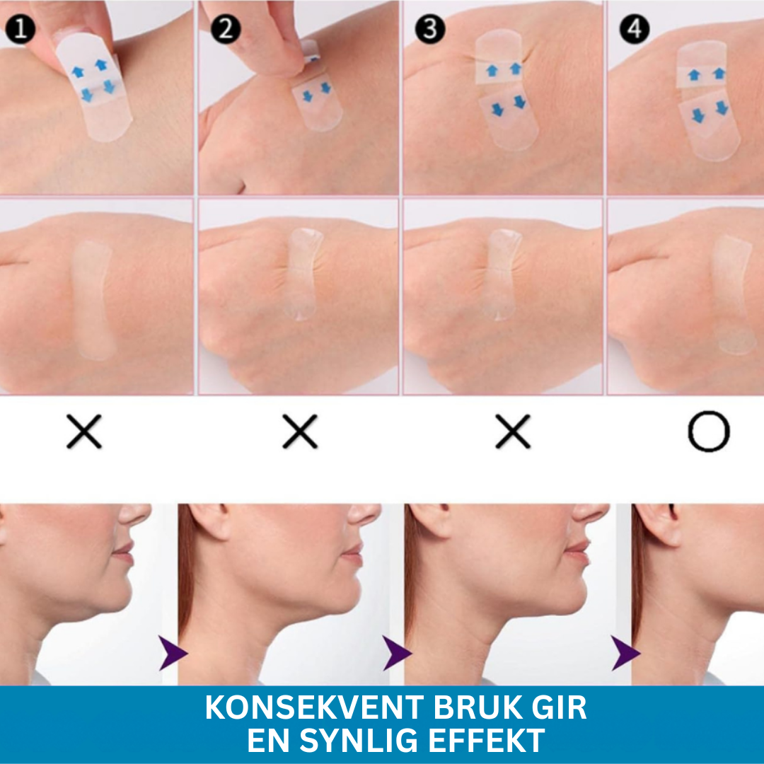 Marga Lifting Strips 2+2