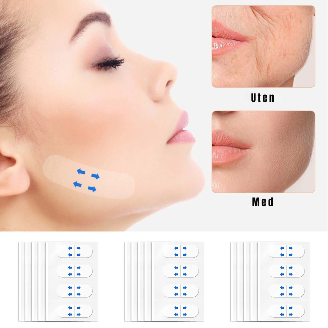 Marga Lifting Strips 2+2