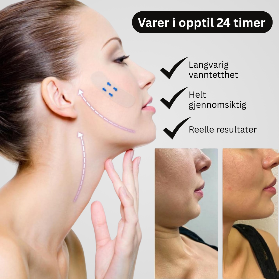 Marga Lifting Strips 2+2