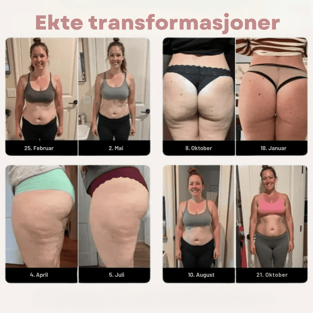 NOVA | Innovativ 3D Anti-Cellulitt Leggings