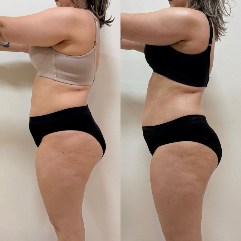 Flowziax Anti Cellulite Massasjeolje