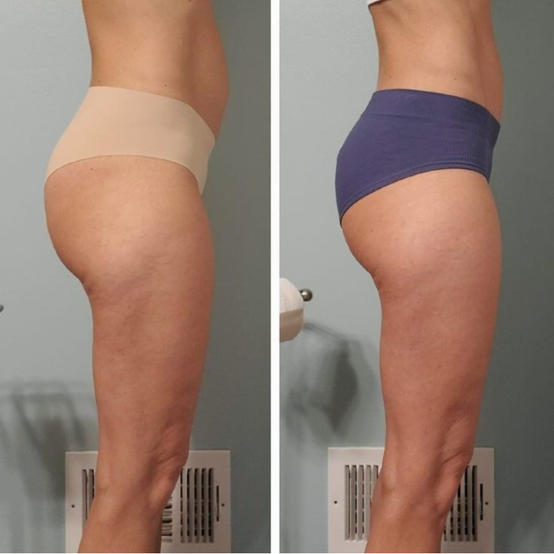 Flowziax Anti Cellulite Massasjeolje