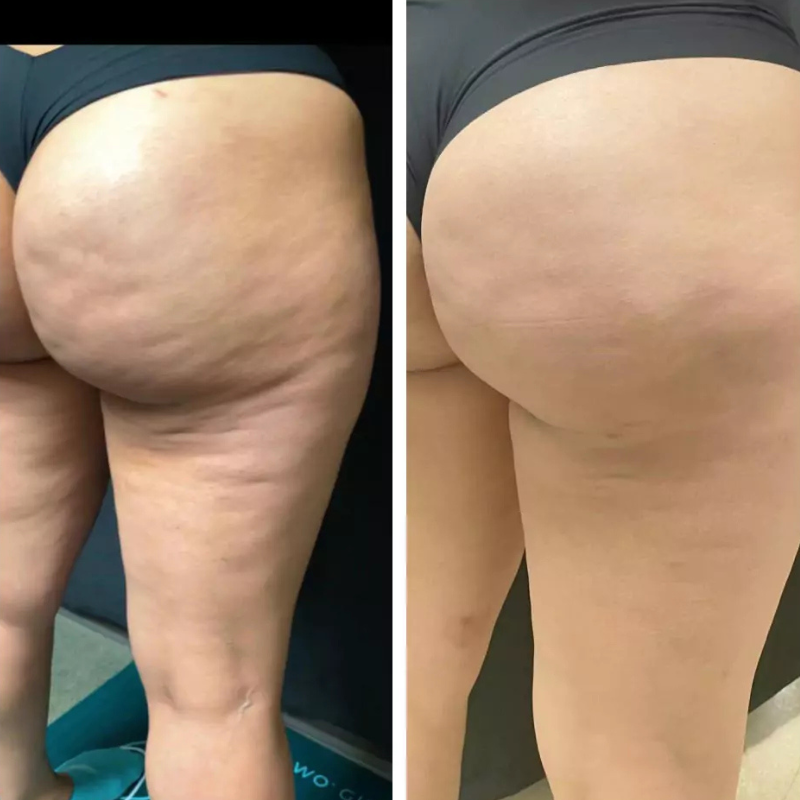 Oce Aura Anti-cellulittkrem