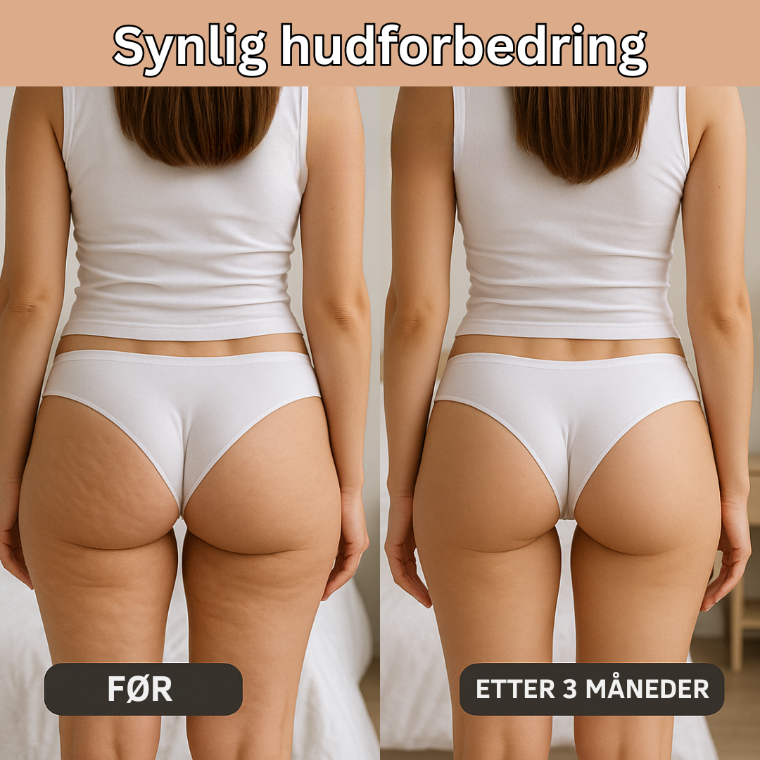 NOVA | Innovativ 3D Anti-Cellulitt Leggings