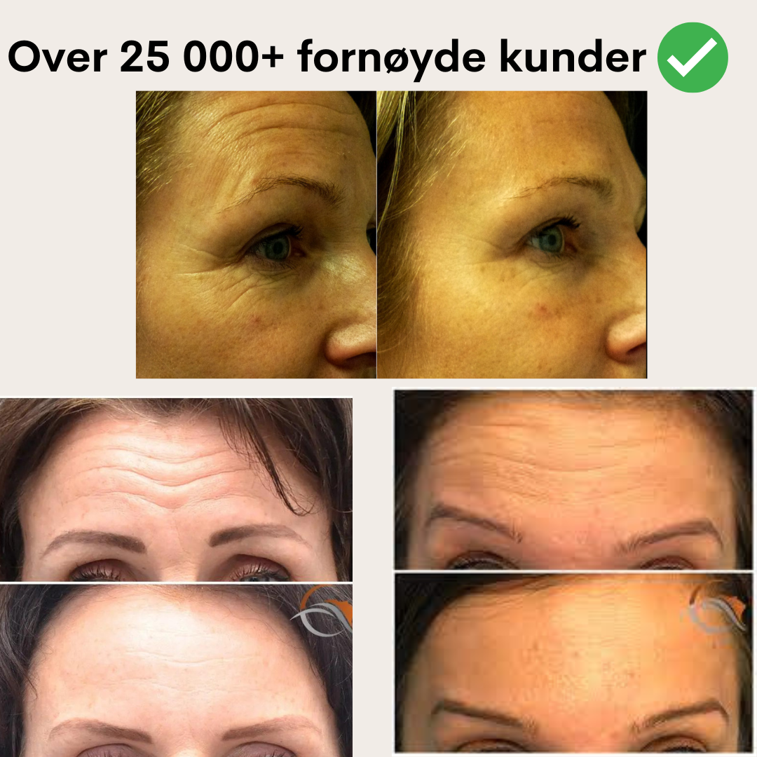 GlowLift Pro™ - Omfavner alderen med strålende hud